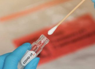 Gobierno ratifica exigencia de prueba negativa de RT-PCR Covid-19 para ingresar a Bolivia gobierno-ratifica-exigencia-de-prueba-negativa-de-rt-pcr-covid-19-para-ingreso-a-bolivia