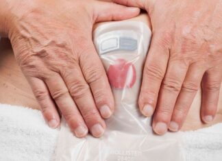 Experto habla de resiliencia y de tratamientos en webinar dedicado a pacientes ostomizados paciente.osteomatizado-