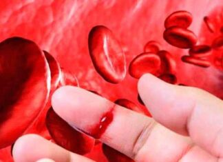 Día Internacional de las Enfermedades Raras: Bolivia registra 126 pacientes con hemofilia dia-internacional-enfermedades-raras-bolivia-126-pacientes-hemofilia
