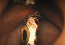 “Together: juntos hasta la muerte”: la película que hizo salir a varios espectadores de la sala por sus impactantes escenas together-juntos-hasta-la-muerte-pelicula-que-hizo-salir-a-varios-espectadores-de-la-sala-