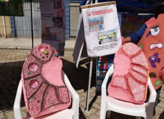 Recomiendan la detección temprana de la tuberculosis para frenar la transmisión