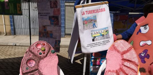 Recomiendan la detección temprana de la tuberculosis para frenar la transmisión